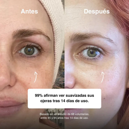 Elimina y reafirma tu mirada cansada en 15 min!